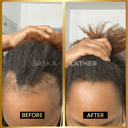 JUMBO Scalp Stimulator