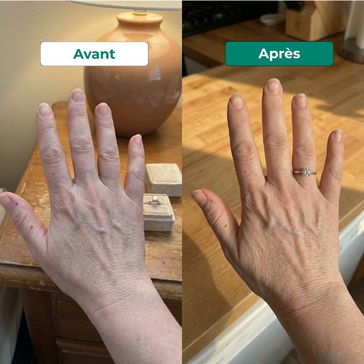 Lumeyr Lymphatic Drainer