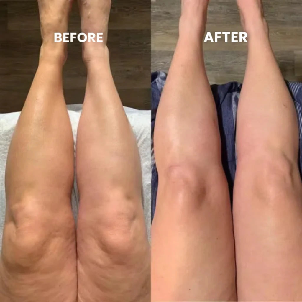 Wellness Drops for Lymphatic Drainage