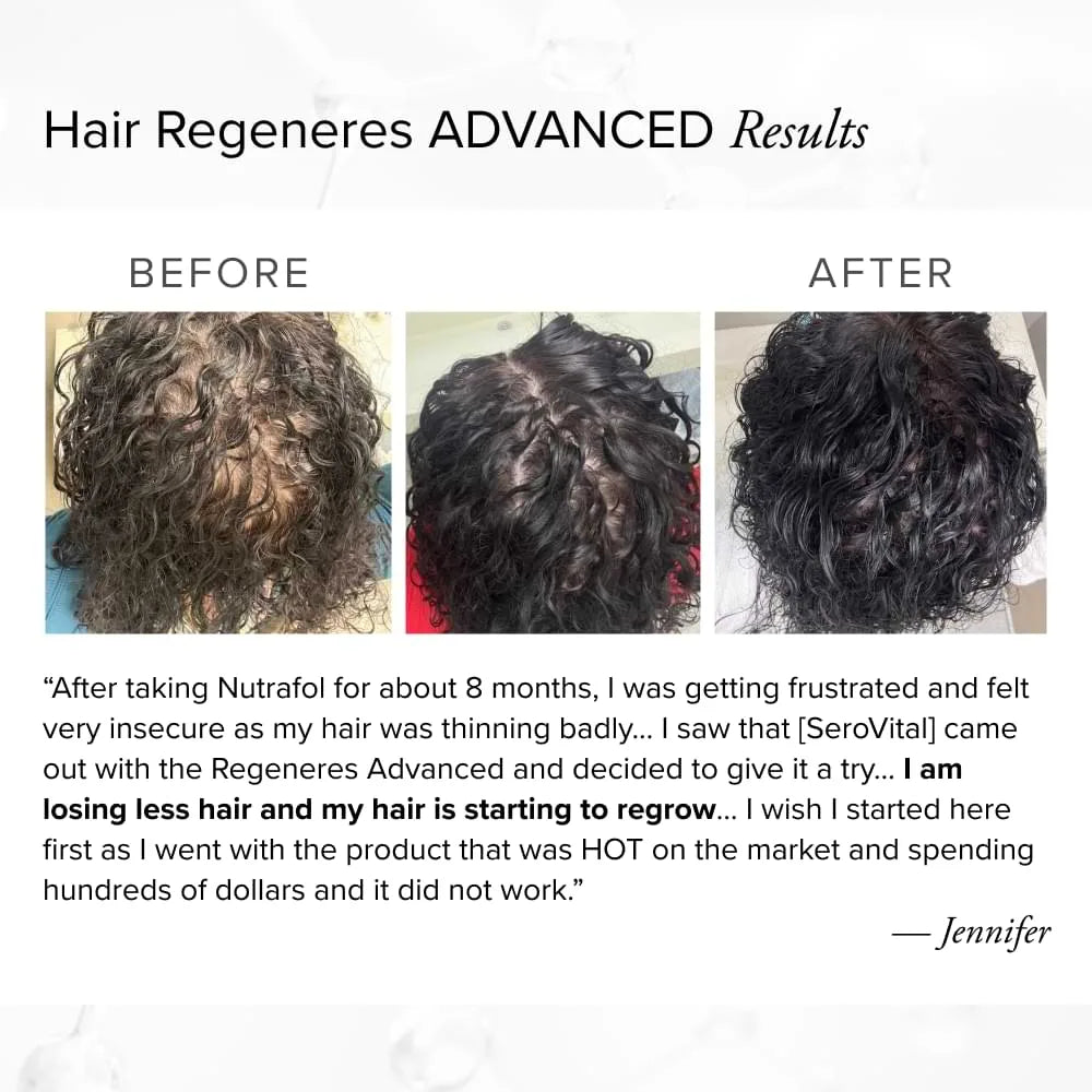 Before and after photos of a customer named Jennifer showing significant hair regrowth and reduced thinning on the top of her scalp after switching to Lumeyr Hair Regeneres Advanced from Nutrafol.